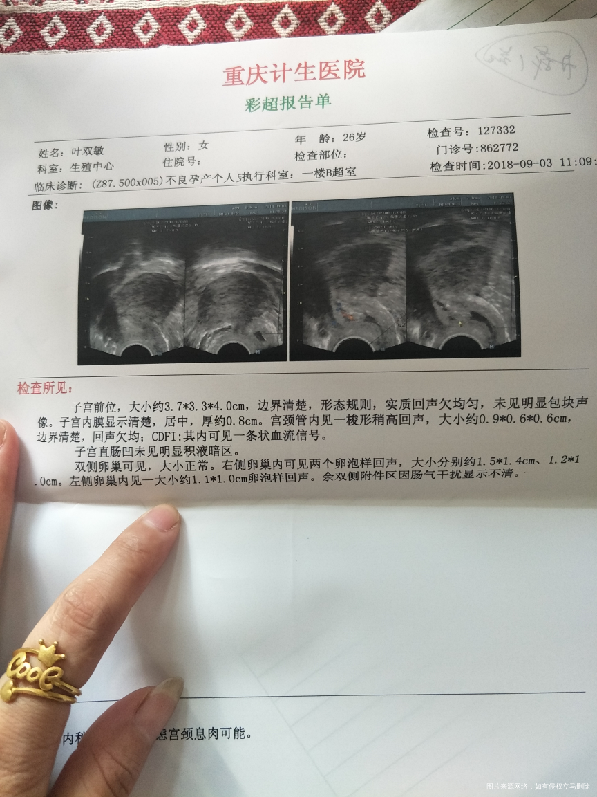 9月3号的检查结果列下