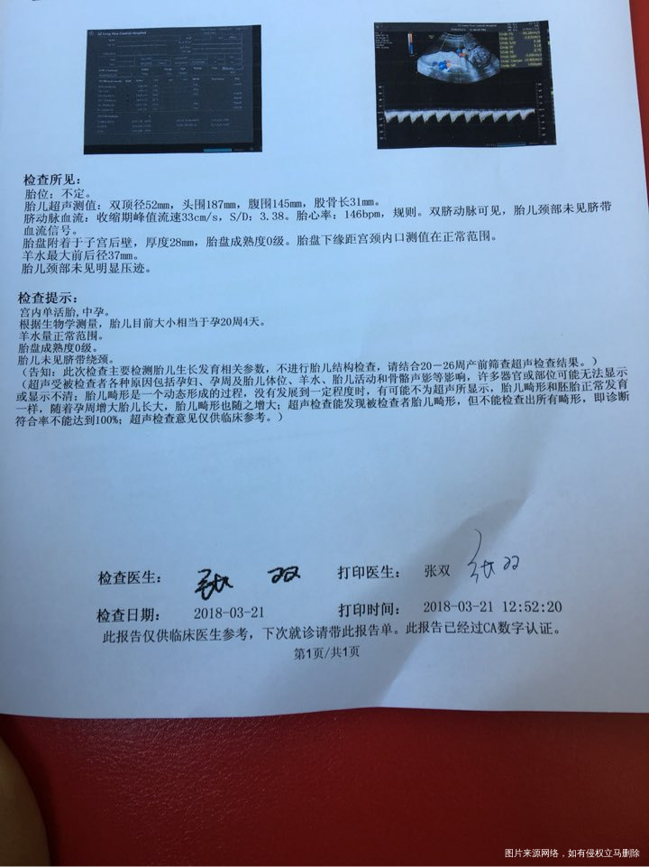 结果出来了,感觉有点不舒服今天过来做个检查