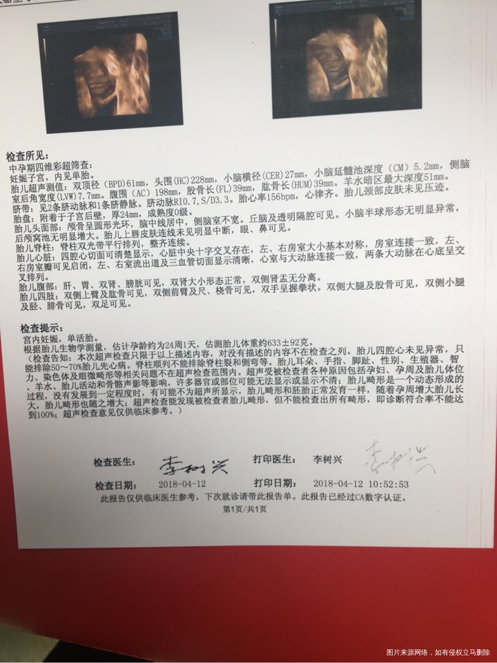 今天做四维了,一次顺利过