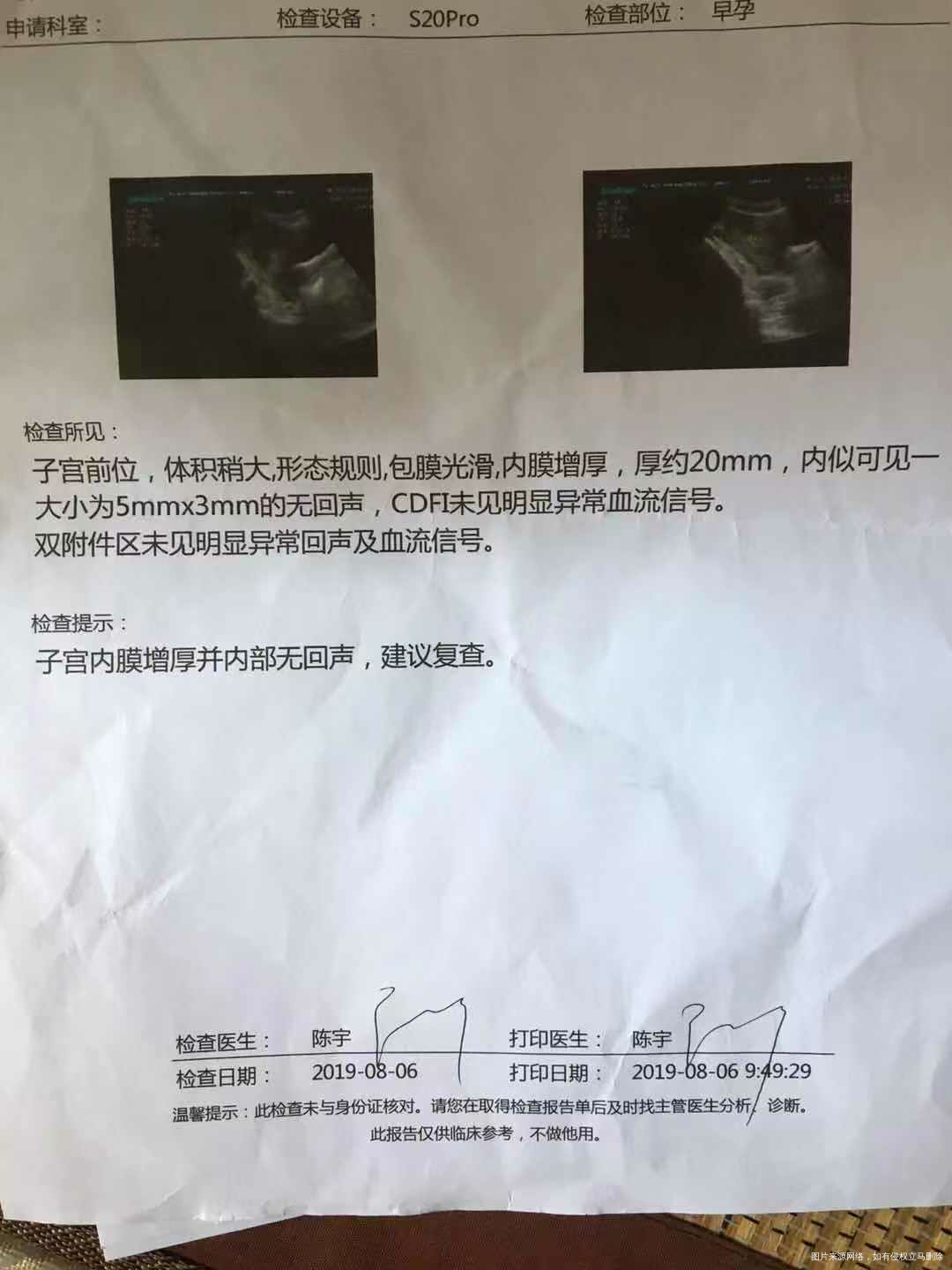 有医生在吗?帮忙看看这结果