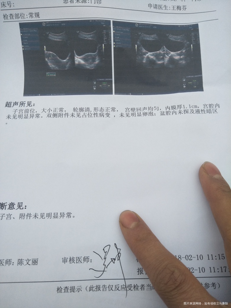 医生你好!我这卵泡正常吗?帮我看看谢谢