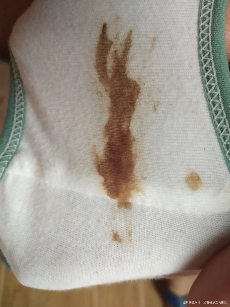 有在线医生吗?帮我看看谢谢