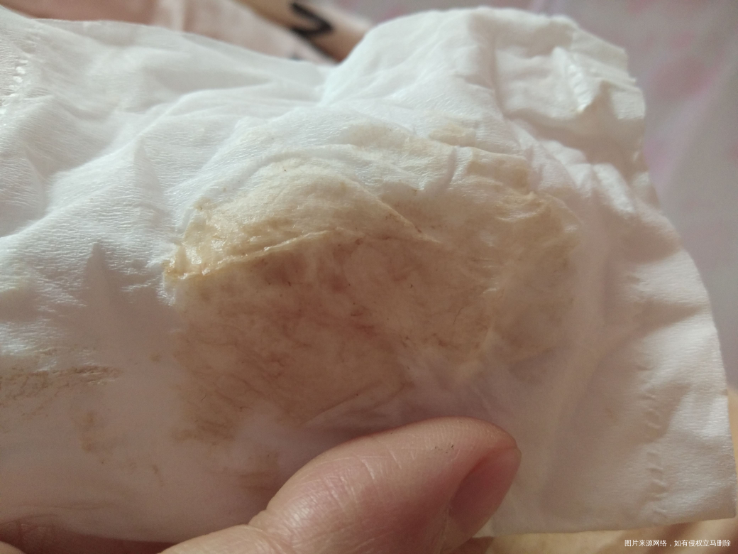 有在线医生吗?帮我看看谢谢