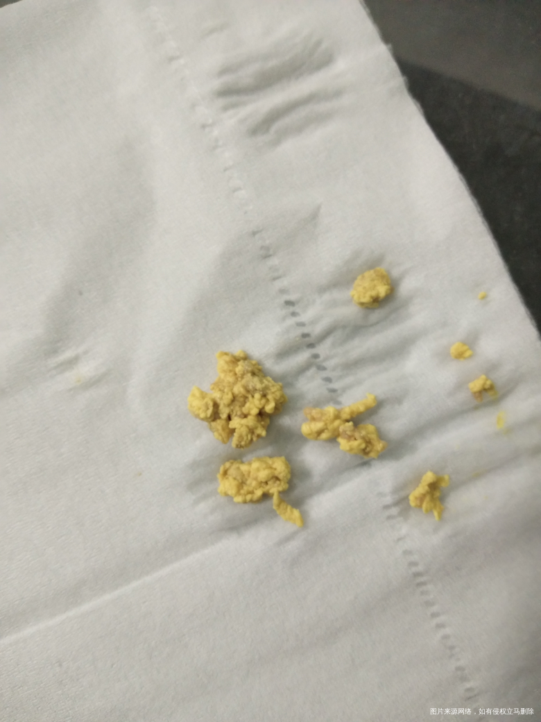 有在线医生吗?帮我看看,急谢谢