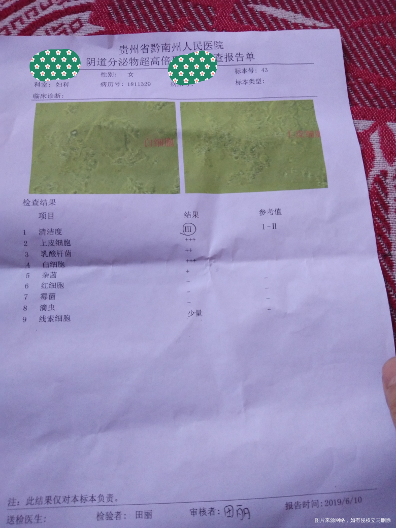 有在线医生吗?帮我看看,急谢谢