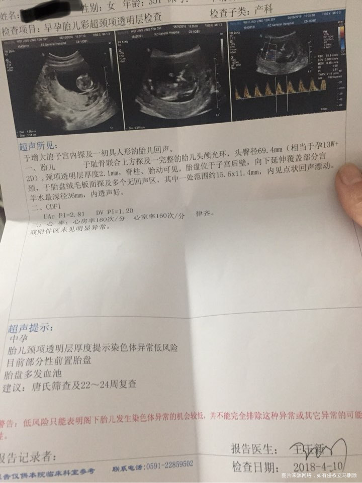 帮忙看看,nt这样的结果问题大吗