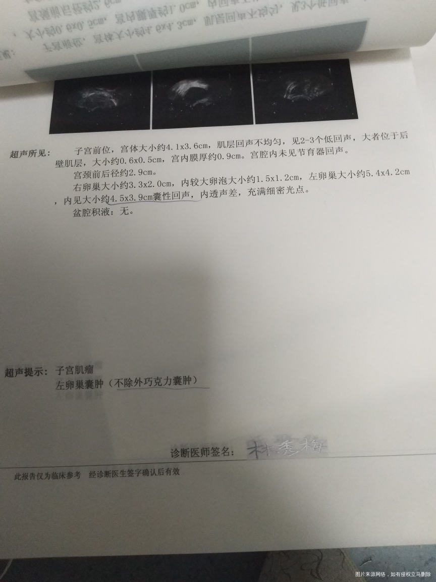 医生帮我看看我不做试管能不能自然怀孕