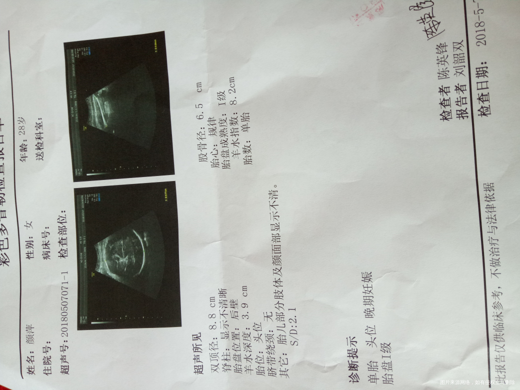 麻烦医生看一下我的羊水是不是太少了,求助