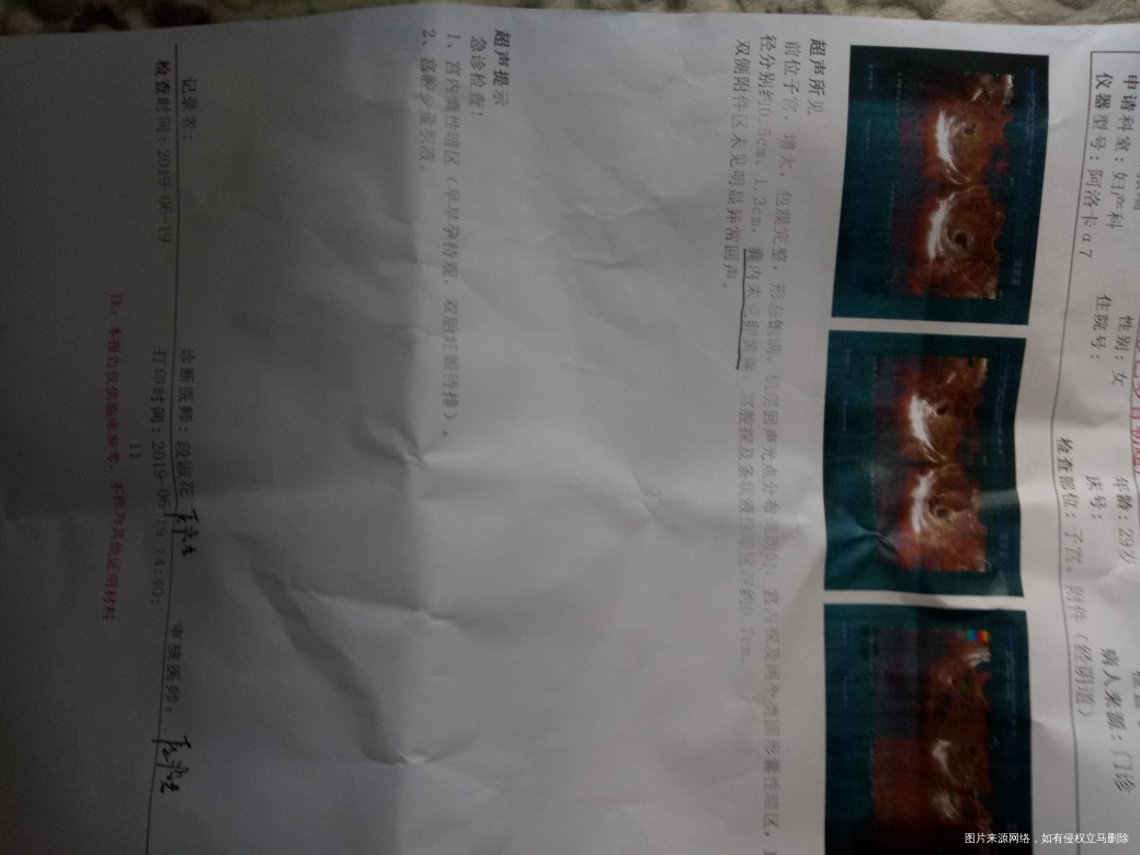 您好医生,这是刚从医院出来的单子,50天