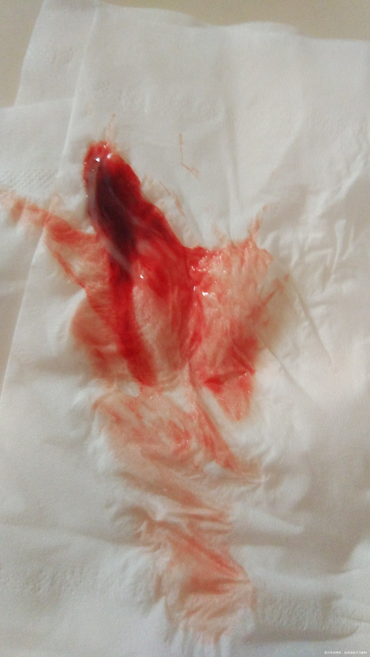 见红后多久发动啊?第一胎,急急急