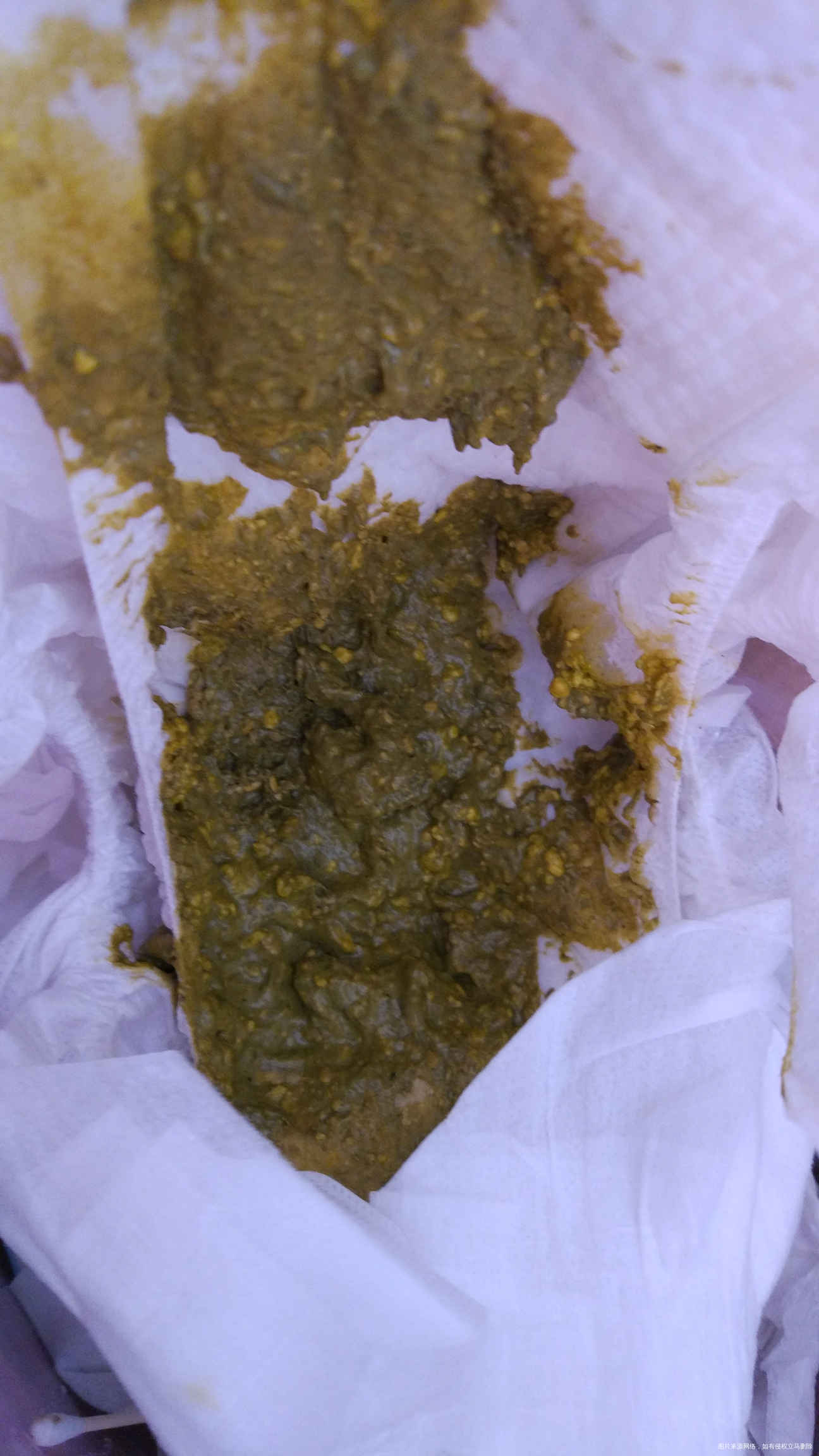 昨天一天一夜,加今天一天没拉粑粑