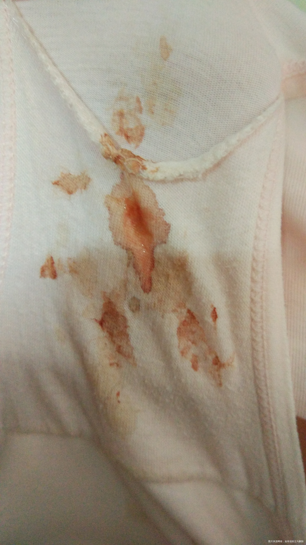 快两个月了,下身还没干净