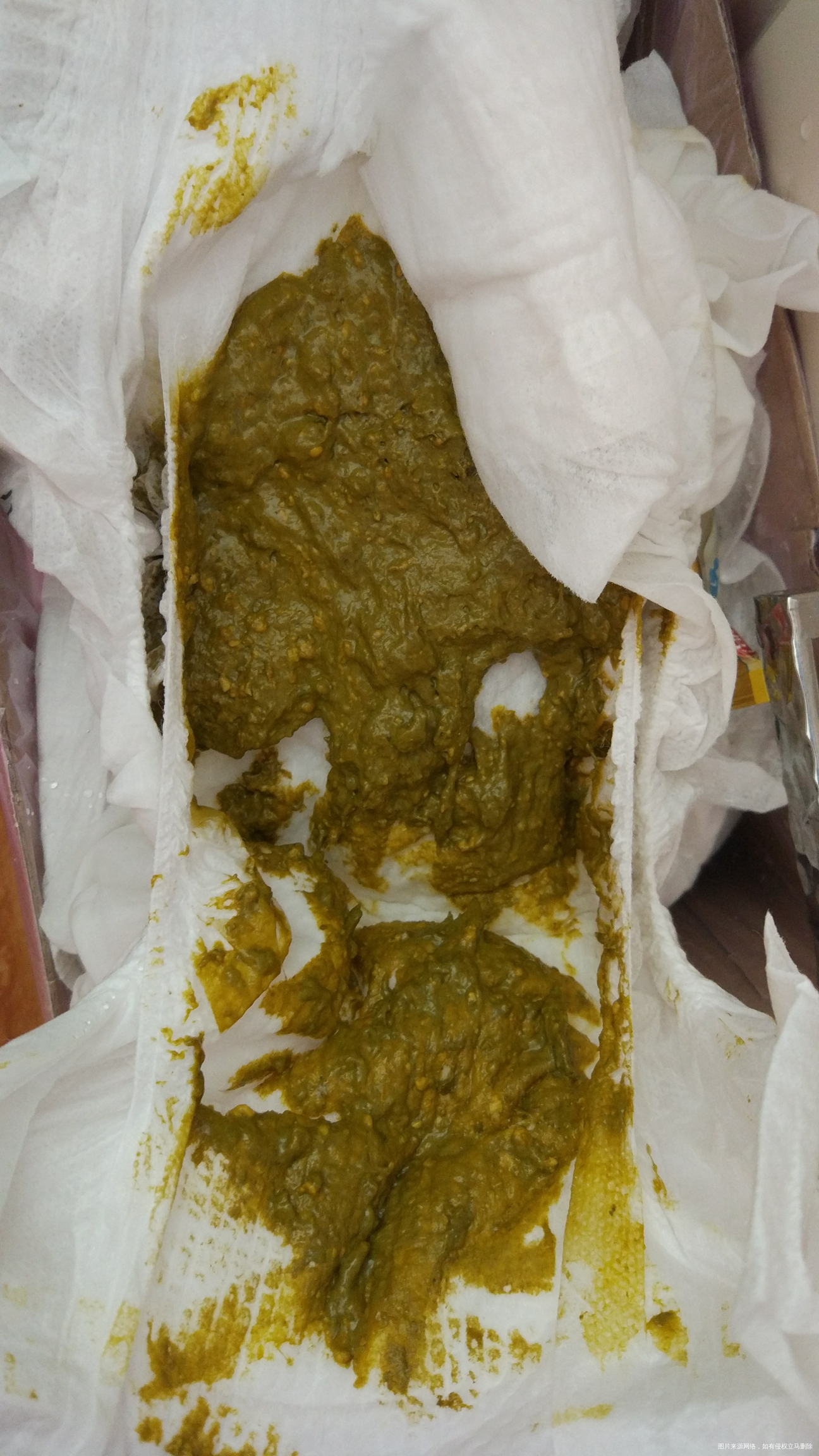 64天的宝宝,今天第三天,这是刚拉的粑粑,医生帮忙看下