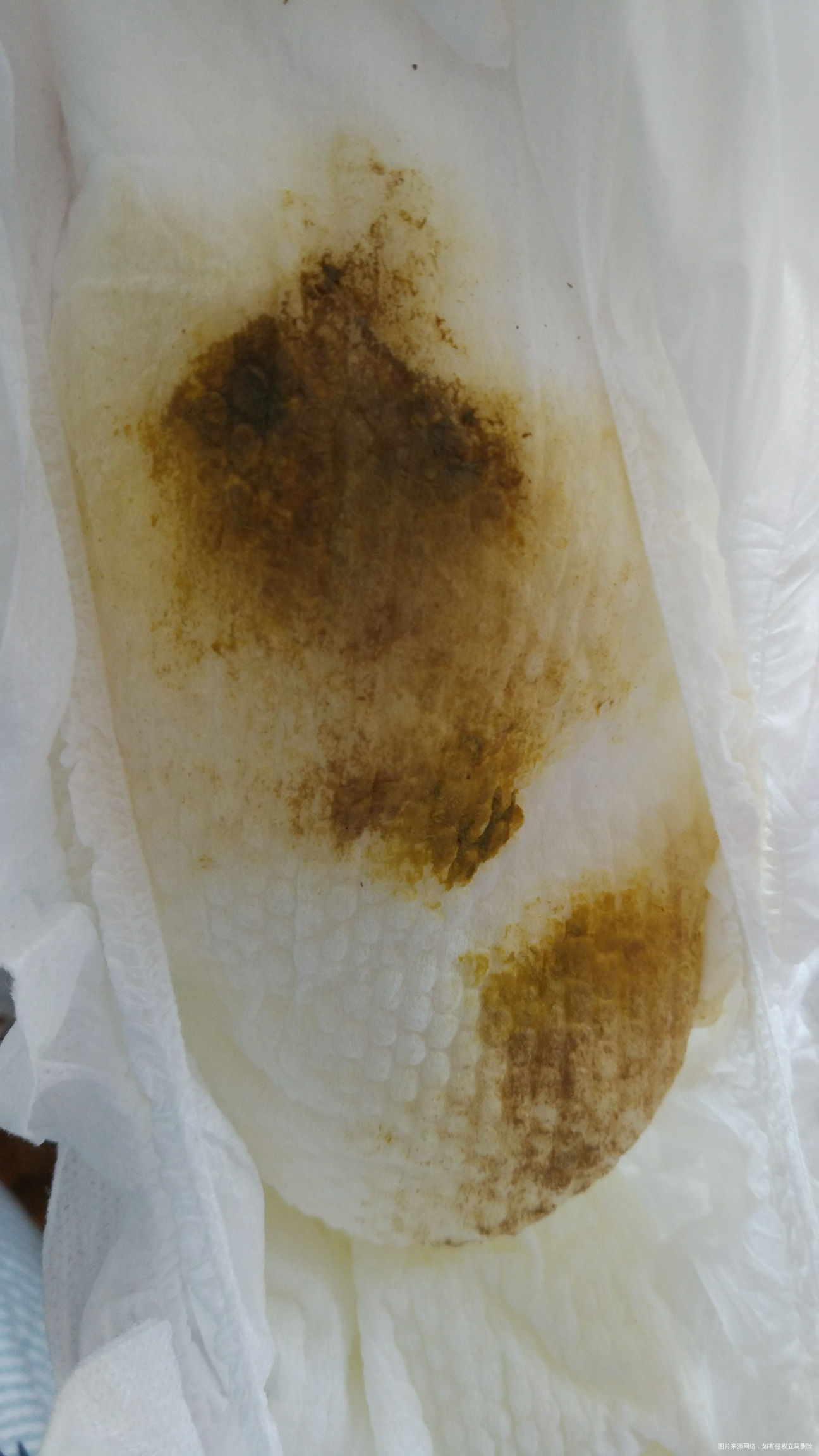 103天了宝宝拉这样的粑粑怎么回事?