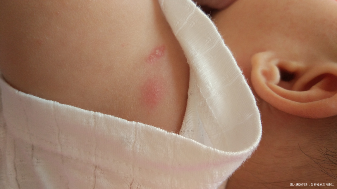 急急急,医生进来帮忙看看