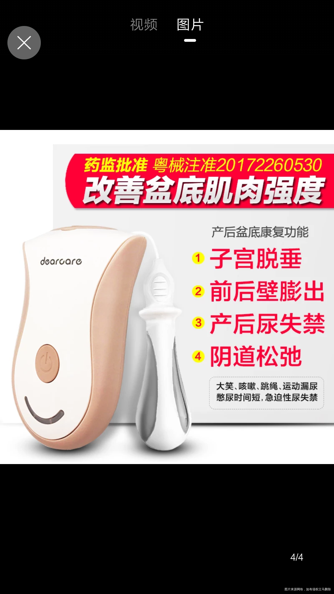 网上卖的电击治疗盆底肌可靠吗?