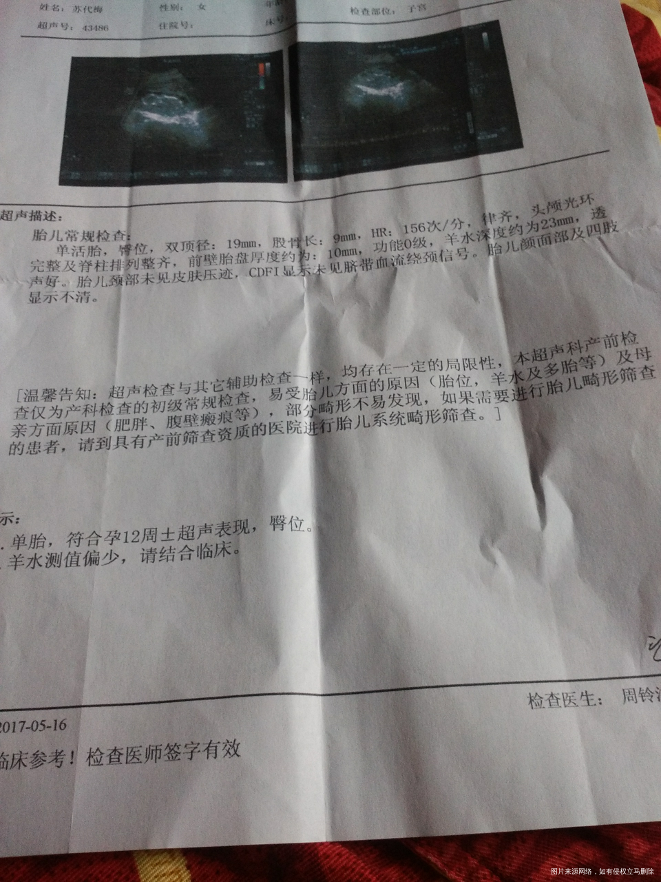 怀孕三个月了检查出羊水测值偏少