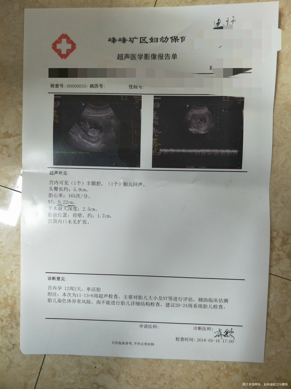 我被建议无创DNA了。