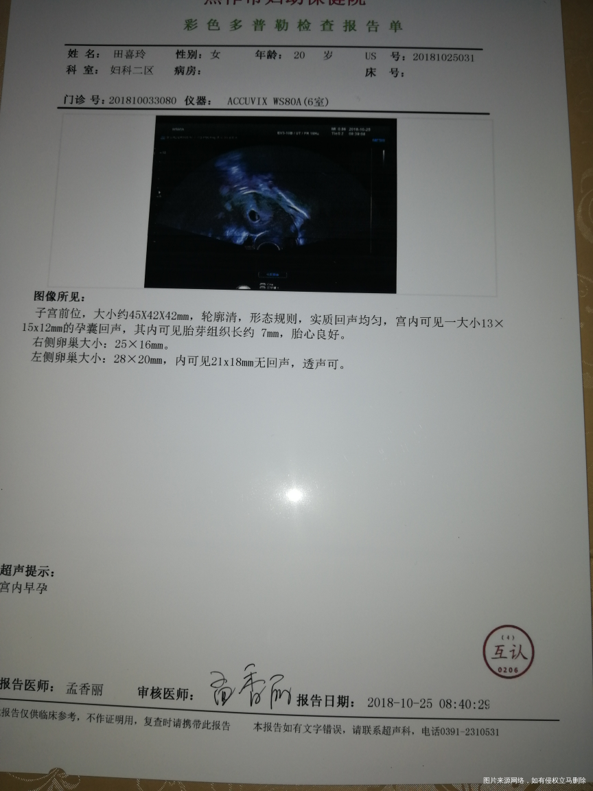 你好,我想问下这种情况能看出在那边受孕的嘛?