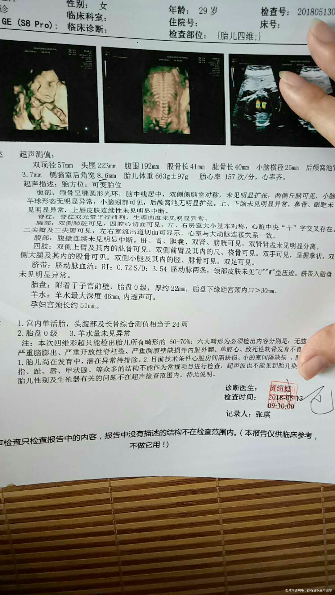 医生帮我看看这个报告有问题吗?