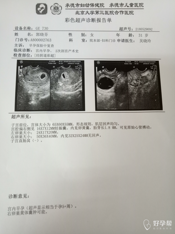 给看看孕囊是男孩女孩,这个数值是长方形还是圆形?