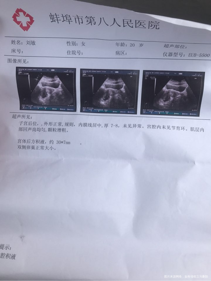 你好今天做的b超请帮我看看