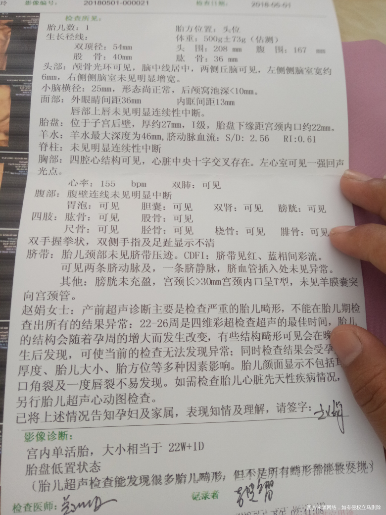 医生帮忙看看左心室可见一强生光点