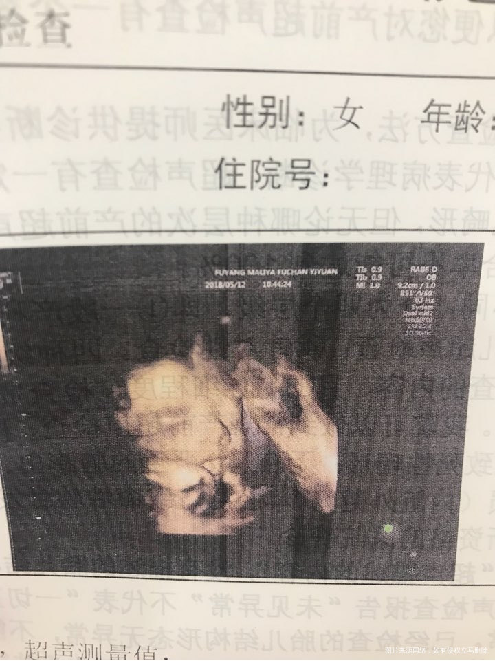 今天母亲节~老公给我妈妈还有奶奶买花的时候顺便问店主要了一支康乃馨替儿子送给我了...