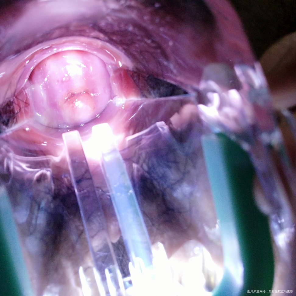 月经干净几天老是又有血,