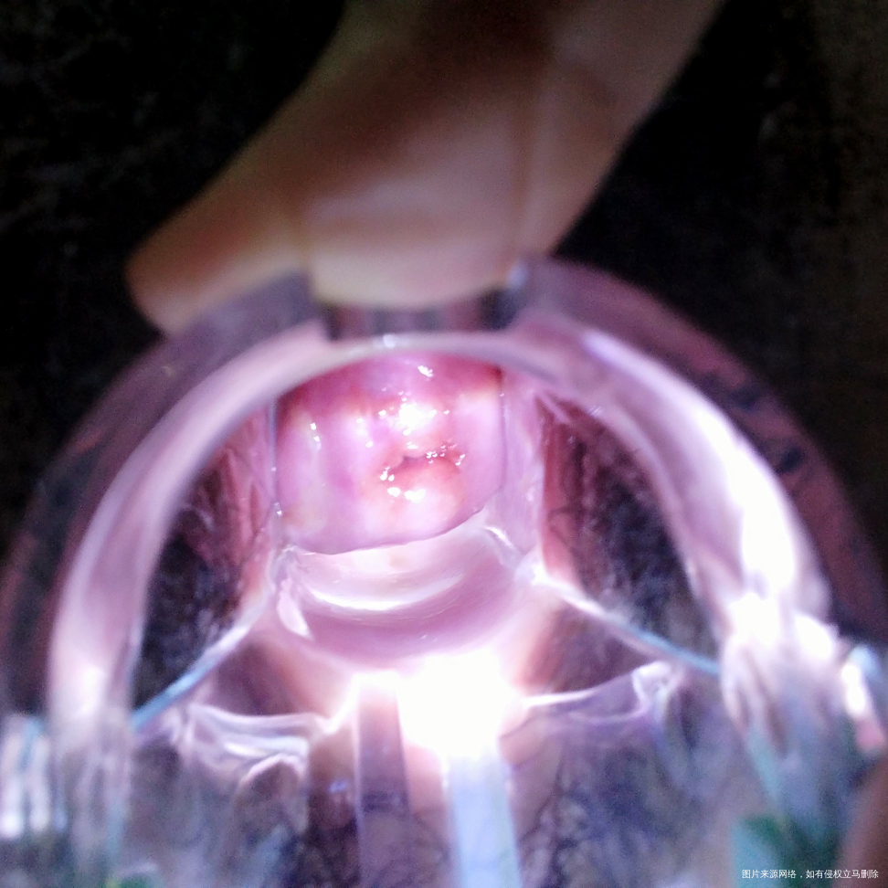 月经干净几天老是又有血,