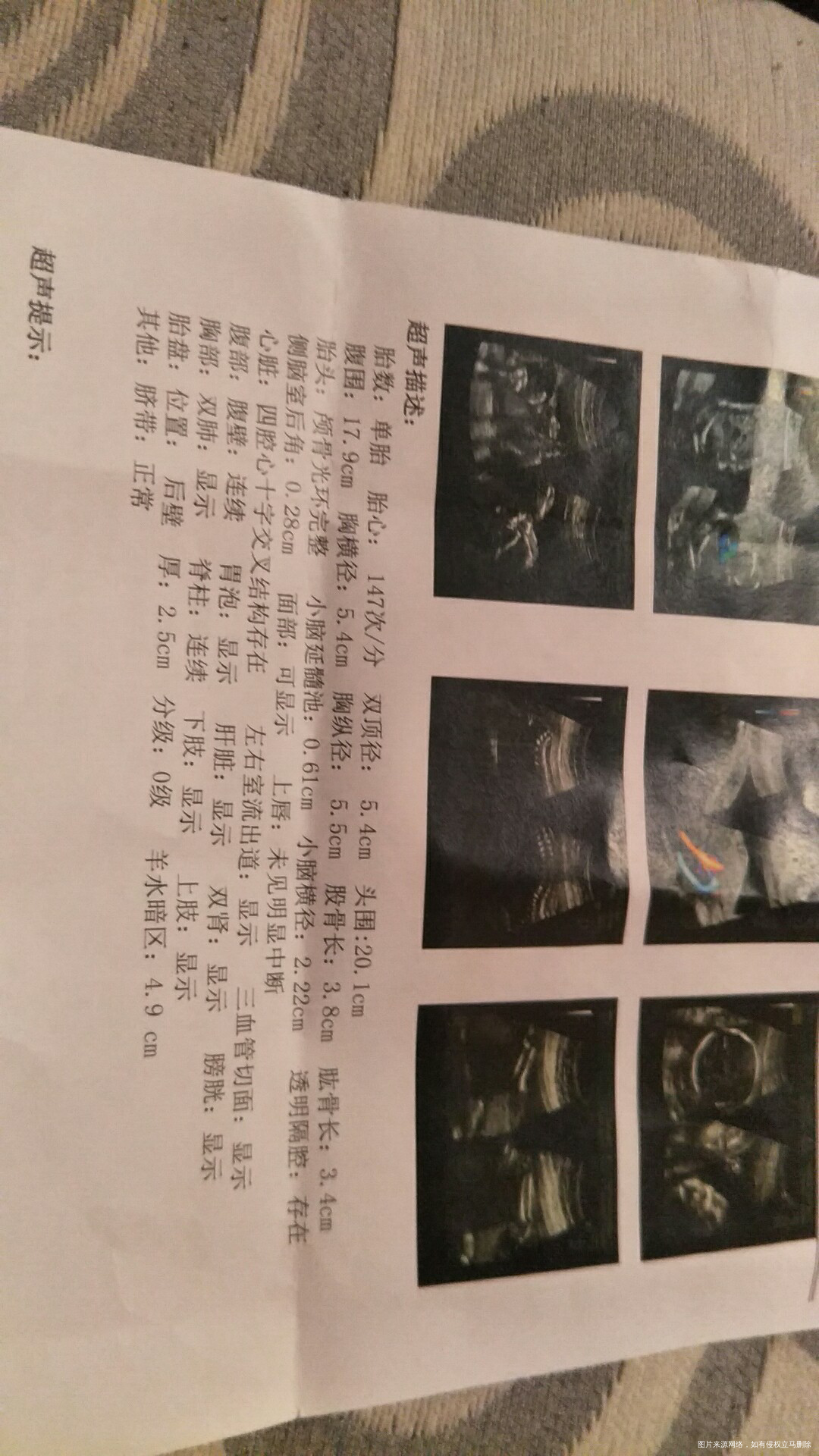 22+2周系统B超顺利通过。。。。。。。