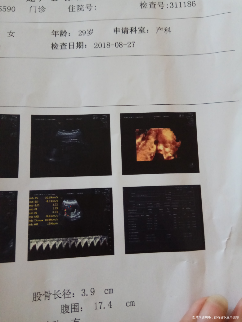 亲们帮我看看像男孩还是女孩??
