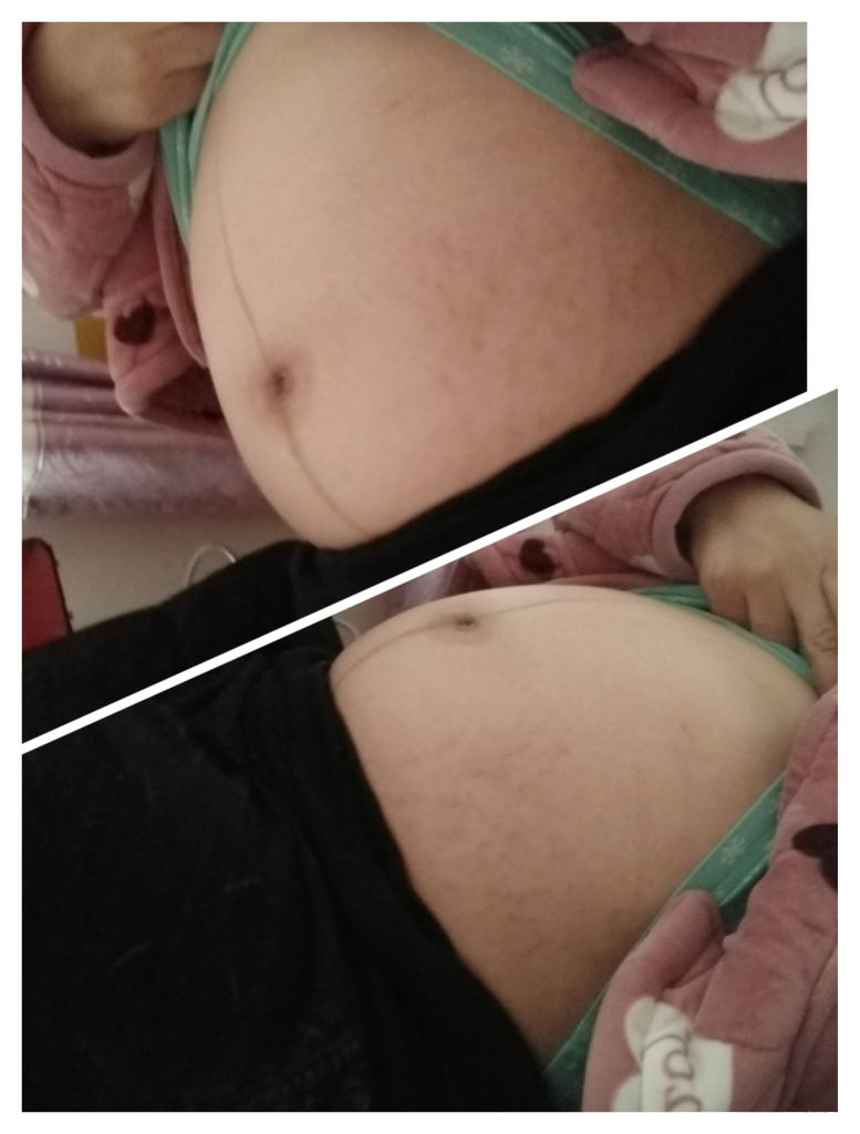 36周多了,我还以为我不会长妊娠纹了,心里还挺得意,没想到最后这一个月还是冒出来...