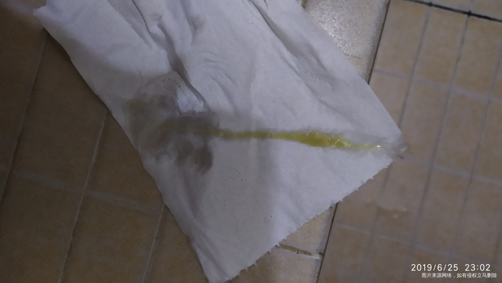 医生帮忙看看白带正常吗