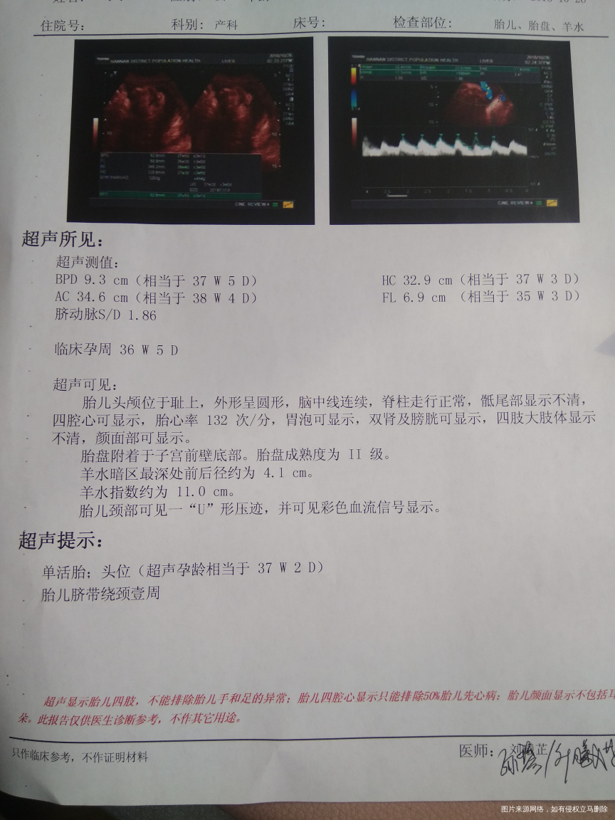 请问医生,胎儿正常不?多重了?