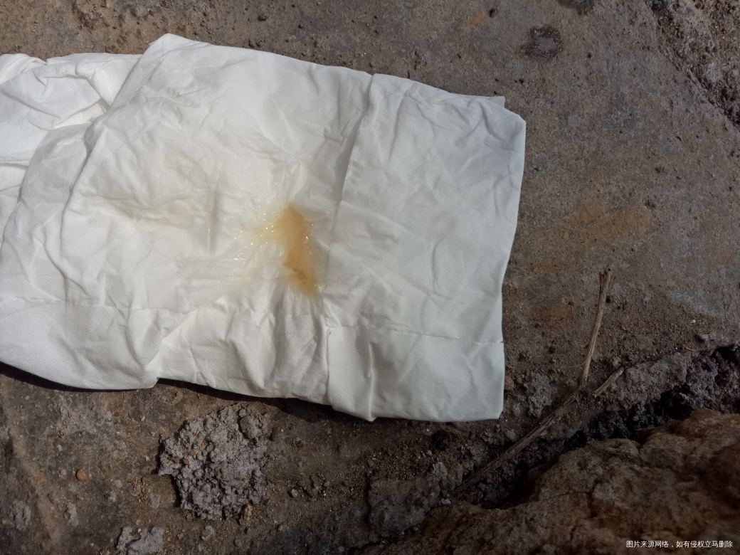 请问这是所谓的见红吗?