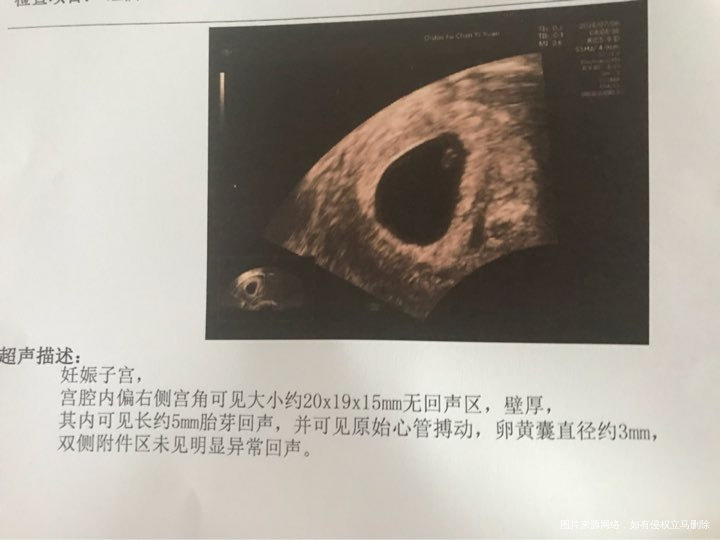 5.16末次,帮忙看一下,偏右侧宫角影响不