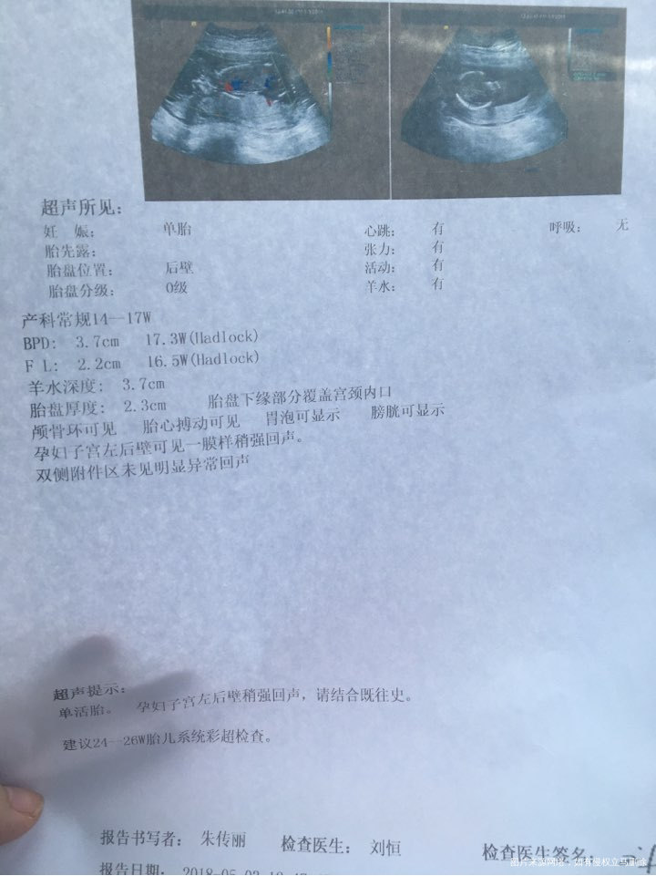 孕十六周做的,麻烦医生看一下