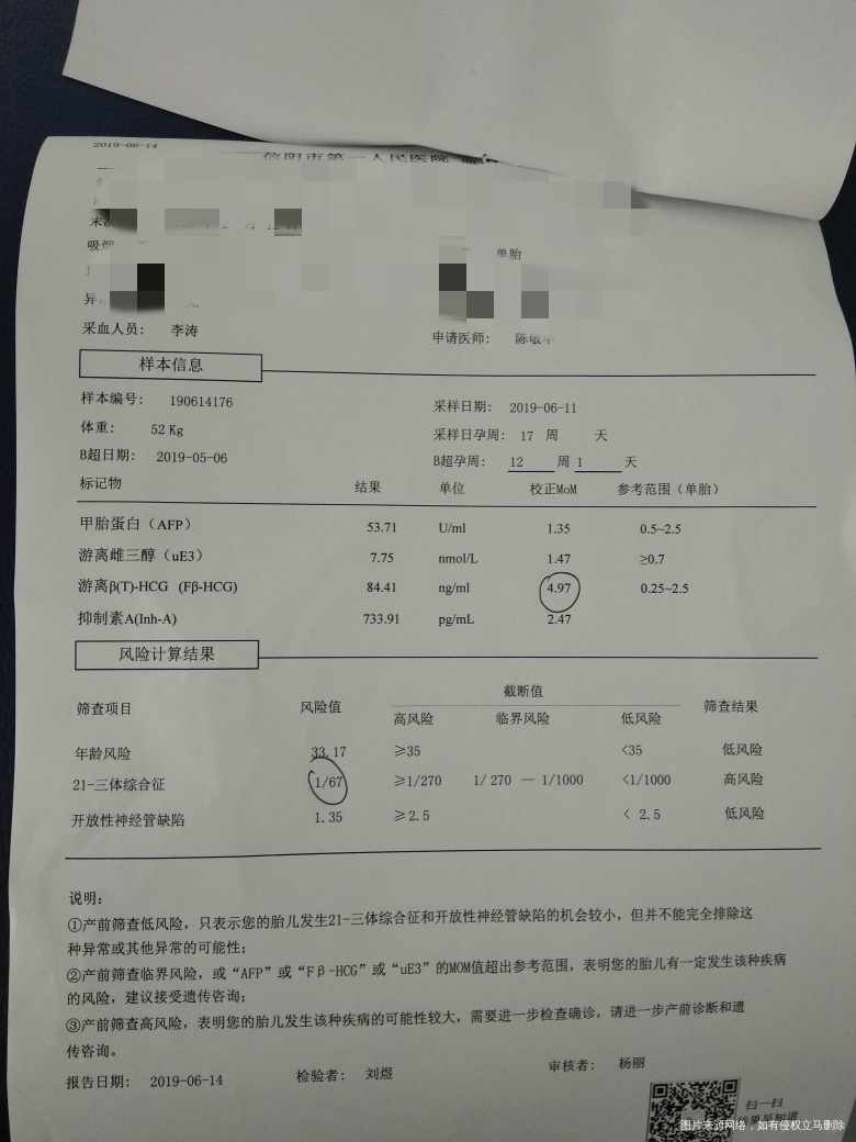 这是今天唐塞结果,医生让在去郑州复查一次