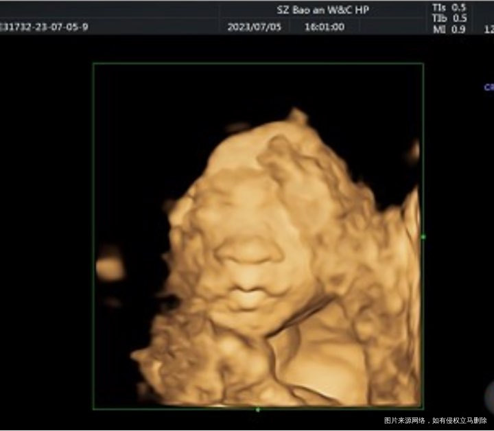 分享我的超快顺产经历