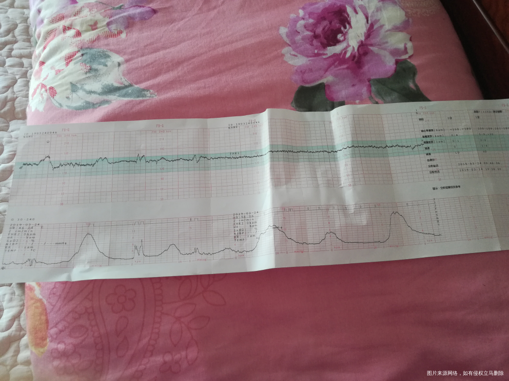 急急急今天刚好40周