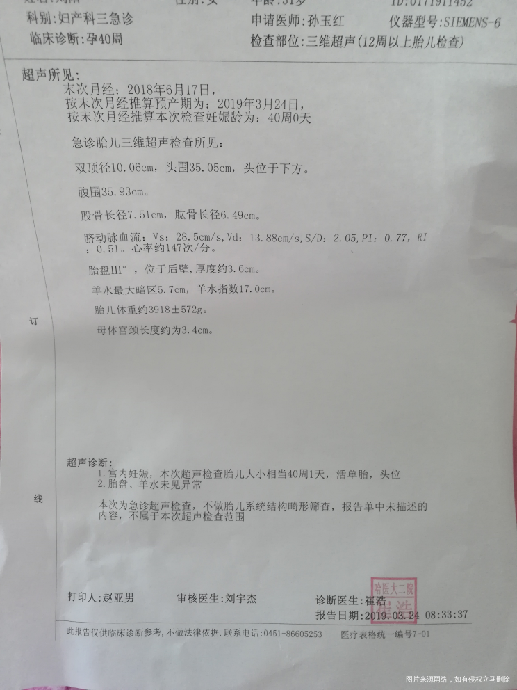 急急急今天刚好40周