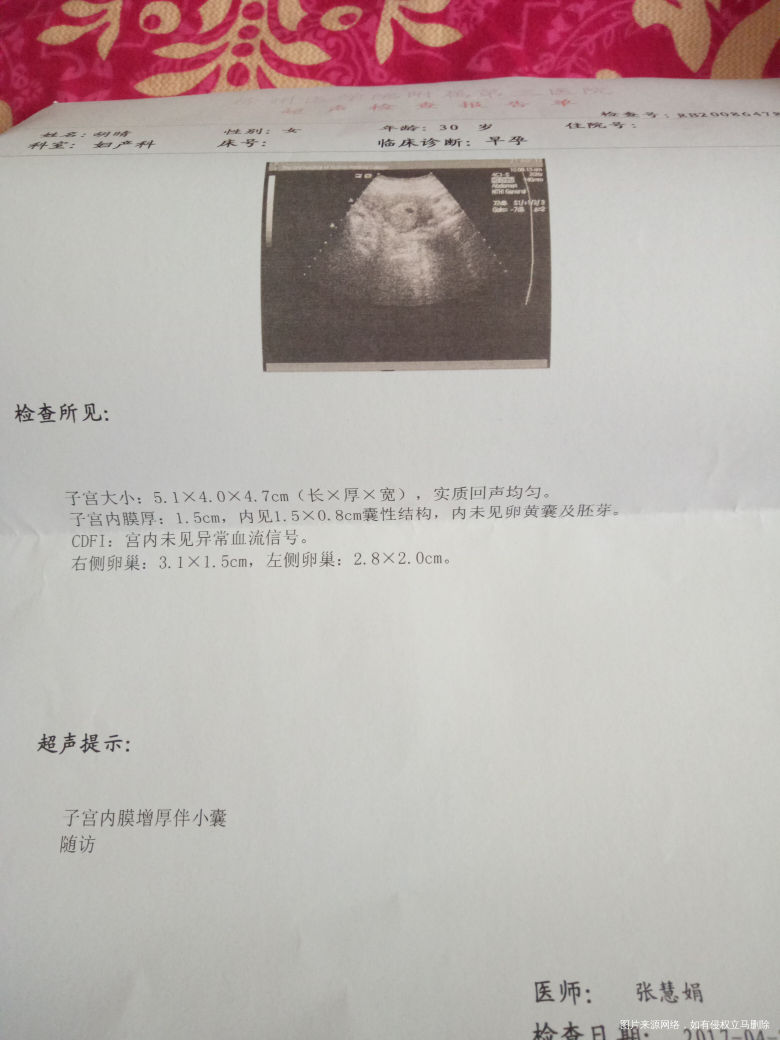 末次月经一个月排卵,3月26排卵同房,