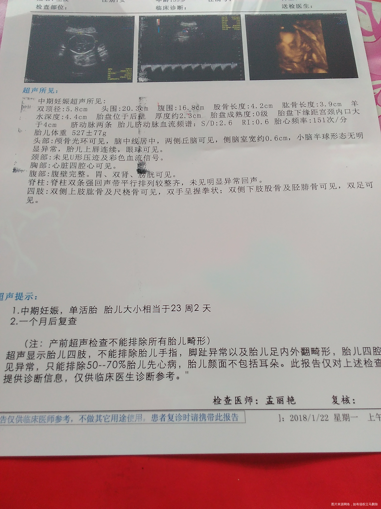 四维彩超用做两次吗,现在31周还用在做吗