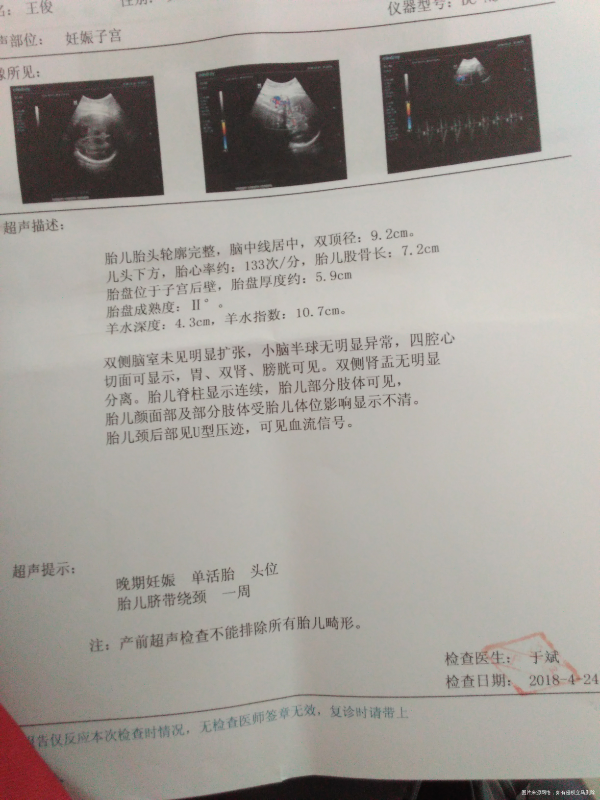 孕37周了,帮忙看看宝宝多大了