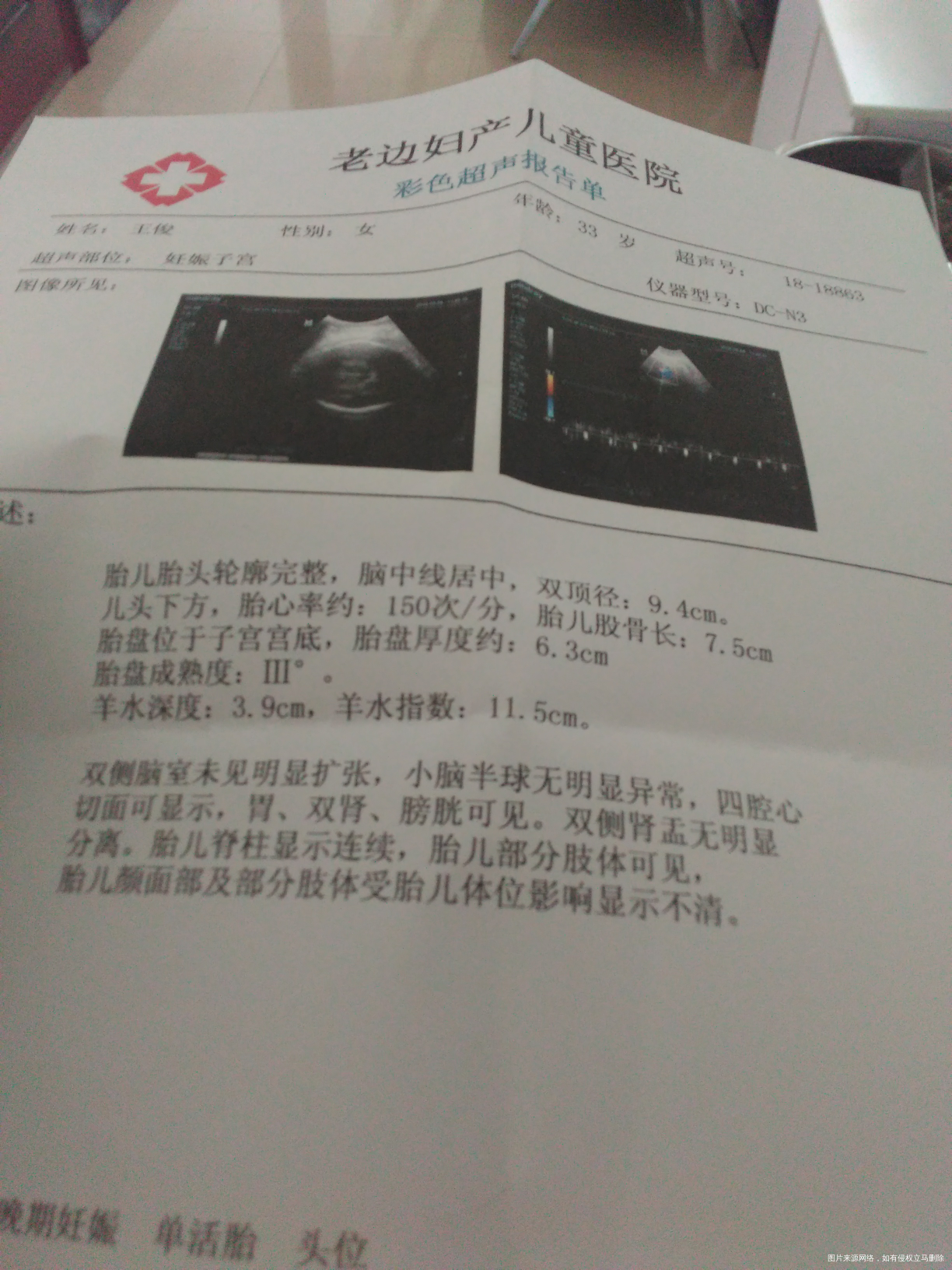 孕39+1了,帮忙看看孩子多大