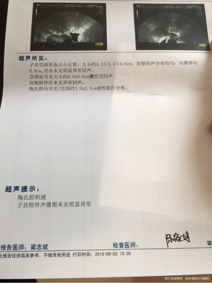 请帮忙看看我的检查报告!给点意见!