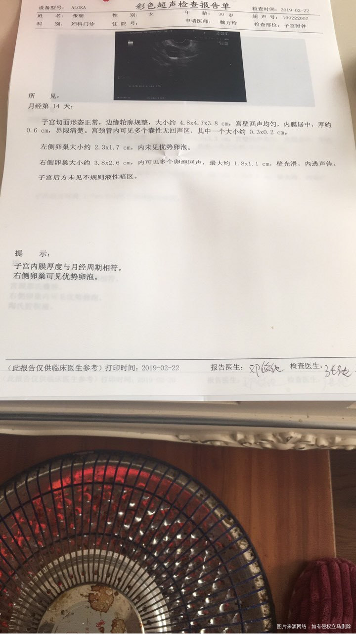 请各位帮我看看卵泡监测报告!!!