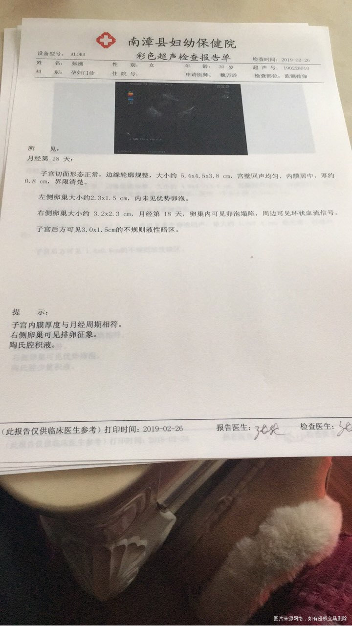 请各位帮我看看卵泡监测报告!!!