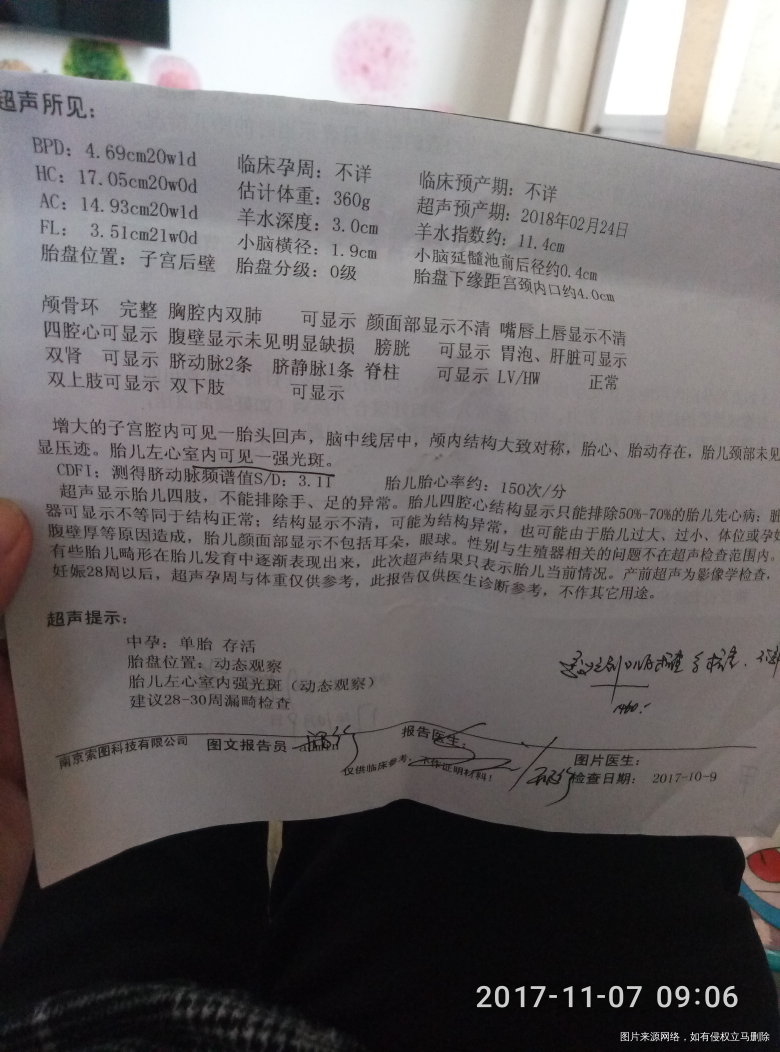 24周+还需要在做四维吗?